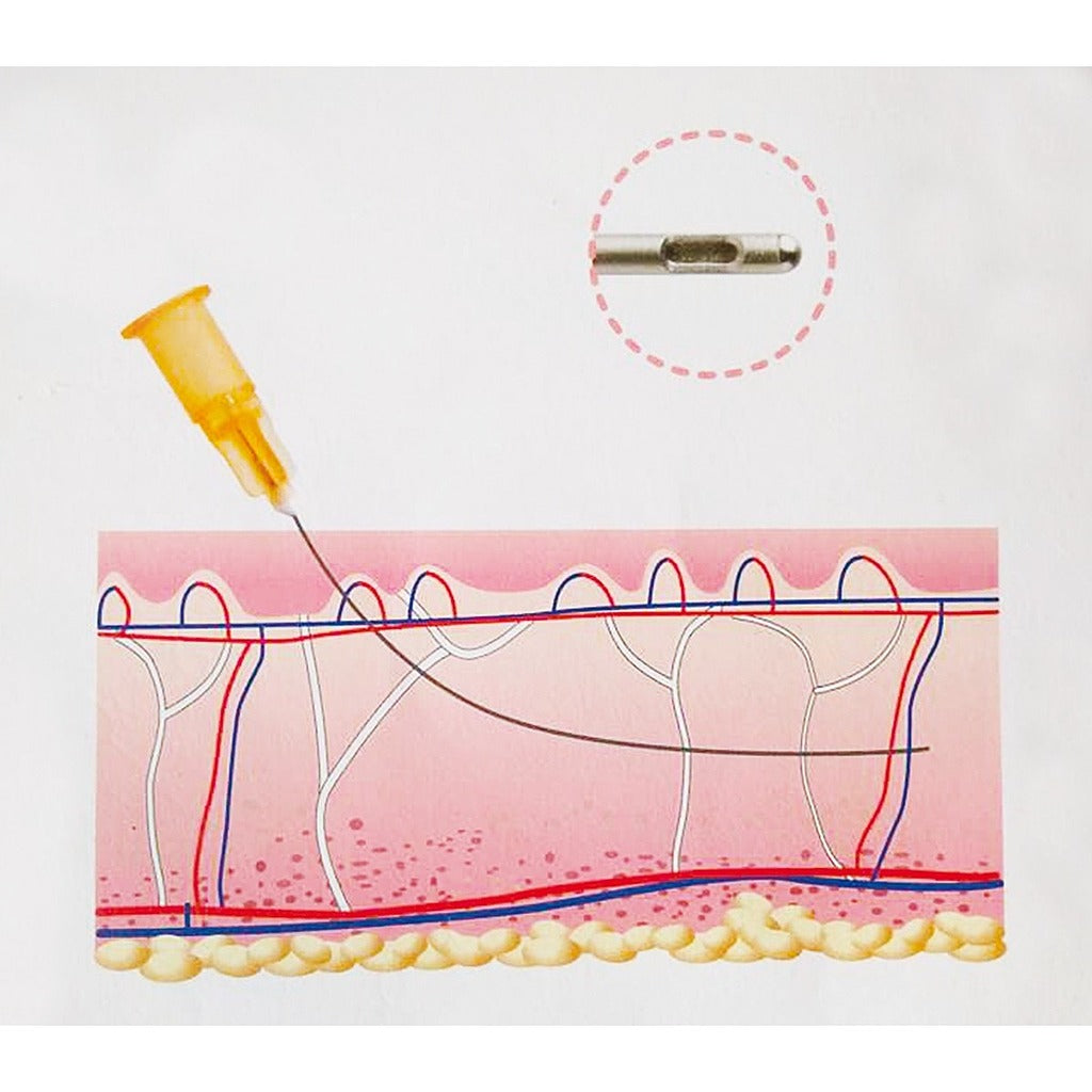 Canule Natural Fill - Boîte de 20