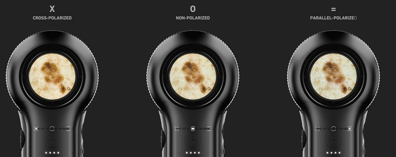 Dermatoscope DermLite DL5