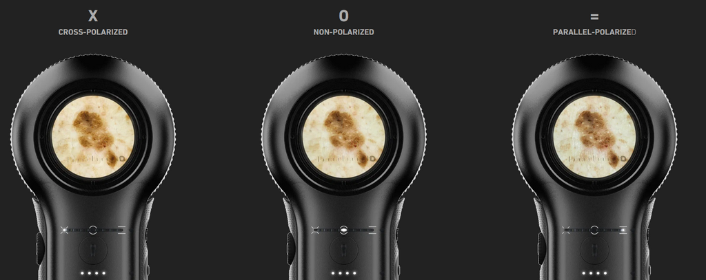 Dermatoscope DermLite DL5