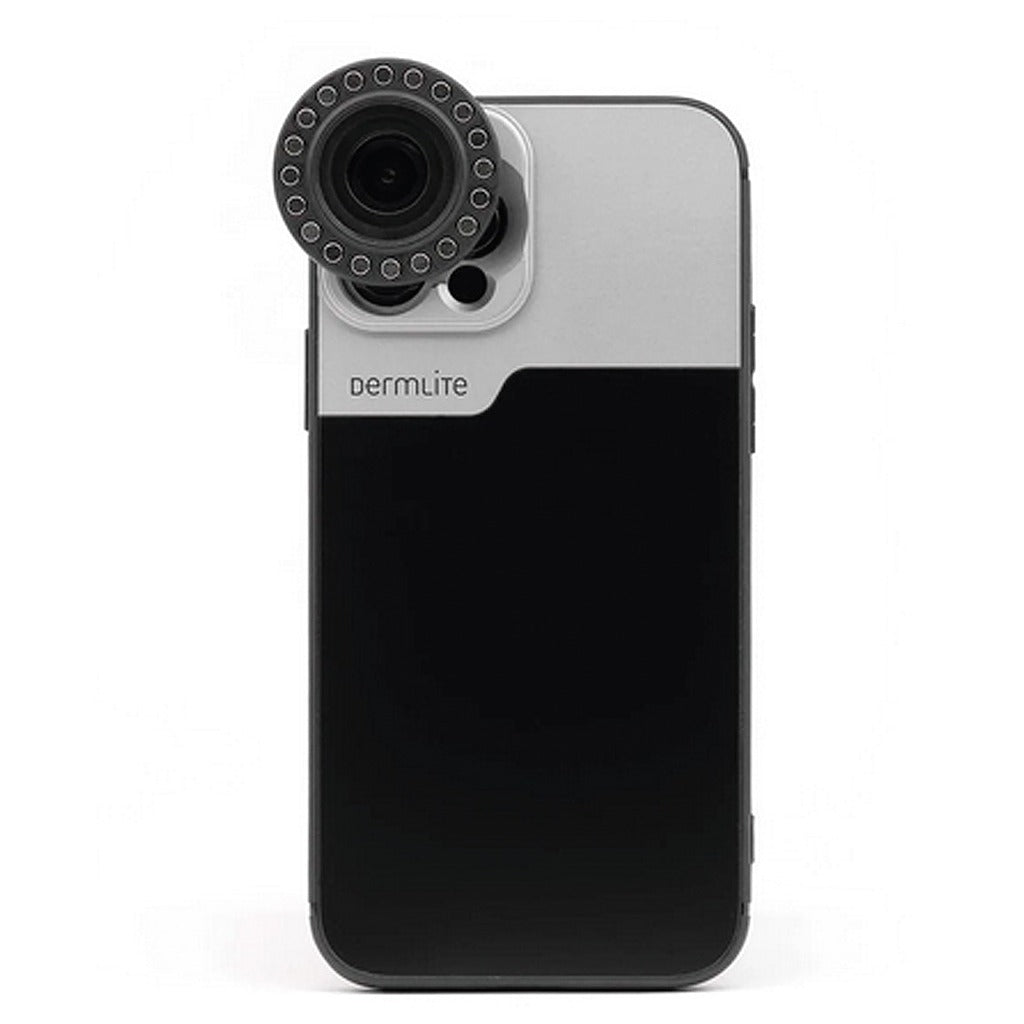 Kit de Connection DermLite pour IPhone 14 et 15 (Plus, Pro, Max)