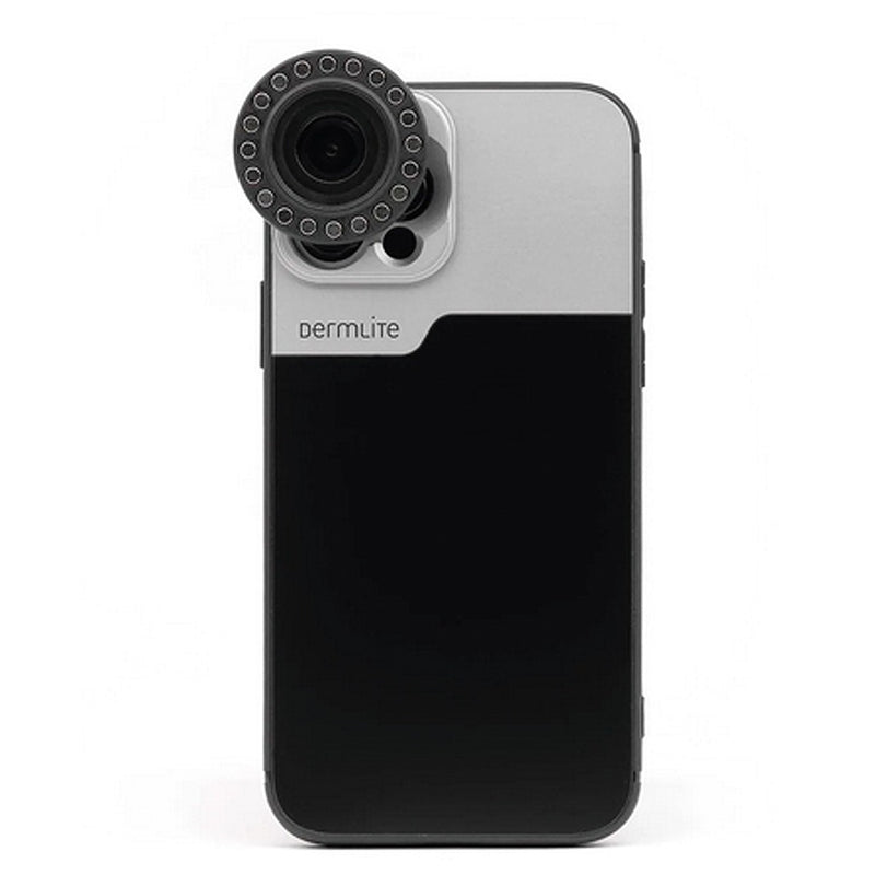 DermLite - Coque de connexion pour iPhone 16, 17 & 18